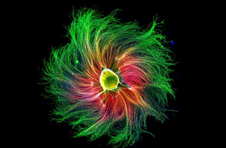 في عالم غير مرئي.. تفاصيل مدهشة تظهر جمال الأحياء تحت المجاهر الإلكترونية