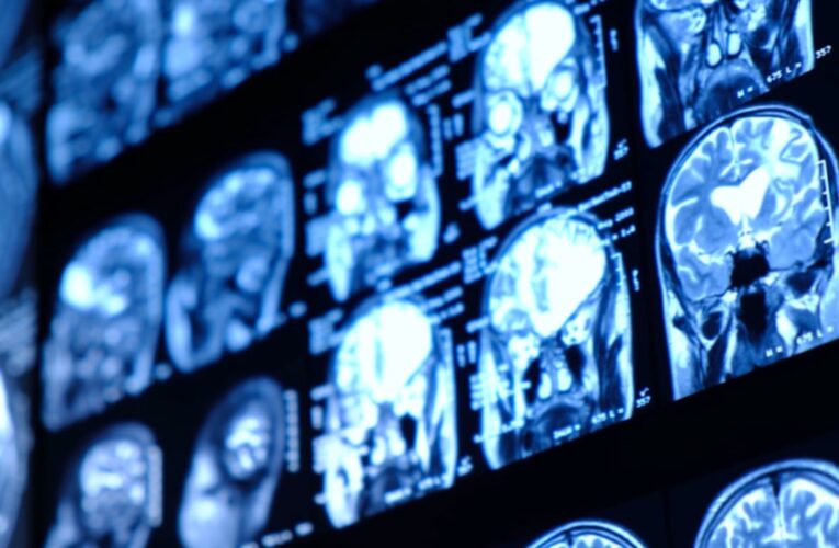 كيف يمكن للتكنولوجيا الكامنة وراء ChatGPT أن تجعل قراءة الأفكار أمرًا واقعًا؟