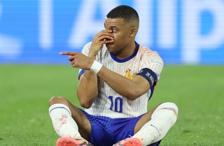 سيرتدي قناع وجه.. ما آخر تطورات إصابة مبابي في “يورو” 2024؟