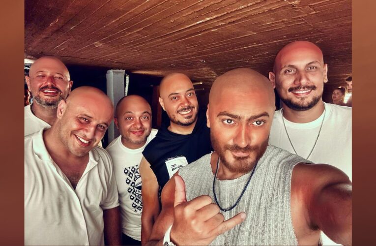 تامر حسني يظهر بإطلالة جديدة ويدعو للانضمام لـ “رابطة لمحبي القُرع”