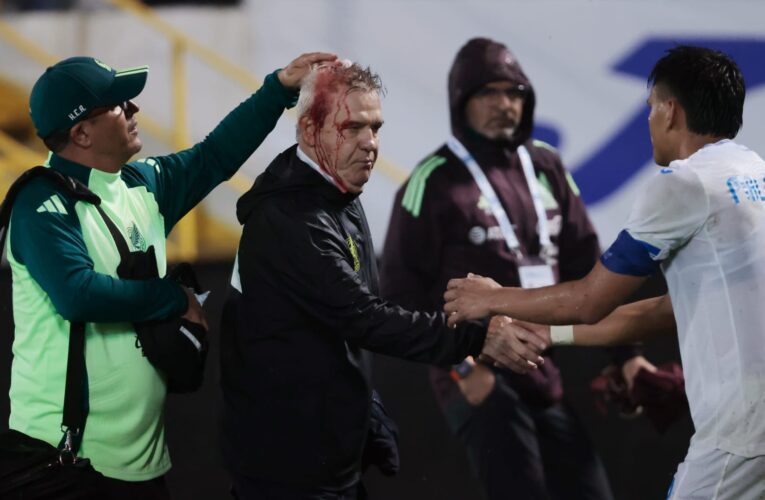 أصيب برأسه وذرف الدماء.. اعتداء على مدرب المكسيك بعد مباراة هندوراس