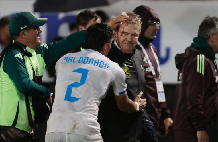نزف الدماء جراء “مقذوفات”.. معاقبة منتخب هندوراس بعد اعتداء على مدرب المكسيك